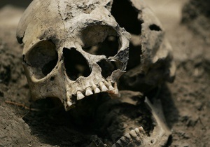 Новини Чехії - черепи - У Празі в сміттєвих баках знайшли 16 пронумерованих людських черепів