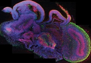 Новости науки - мозг: Австрийские ученые вырастили подобие мозга