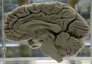 Мозок - Учені виявили різницю в роботі мозку лібералів і консерваторів