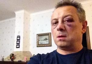 Напад на депутата - Побитий під Києвом депутат від партії УДАР: Жити буду, зараз зі мною все ок