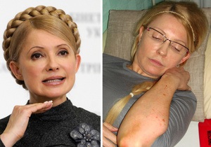 Тимошенко заявила, що в лікарні їй у косметику додають отруйні речовини