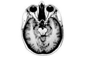 Нейробіологи дослідили мозок власників автобіографічної пам яті