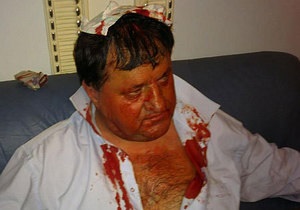 У парламентській бійці бютівцю розбили голову. Його госпіталізувала швидка