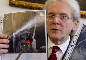 У Тимошенко хронічна грижа міжхребцевого диска - німецькі лікарі
