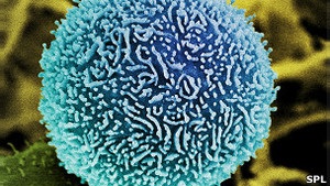 Експерти пояснили, чому в Україні частіше хворіють на рак