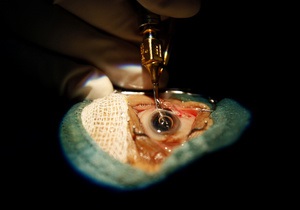 У Британії почали відновлювати зір за допомогою стовбурових клітин