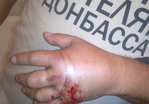Чоловік у футболці Спасибо жителям Донбасса переніс операцію і написав заяву