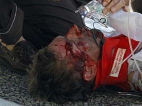 Німець отримав струс мозку і перелом скули після падіння на Тур де Франс