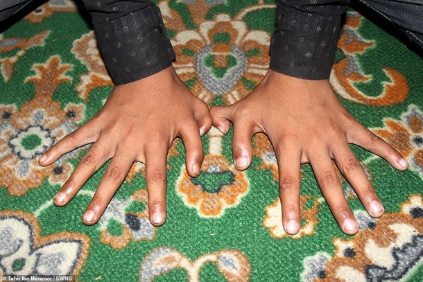 Мальчику из Индии лишние пальцы помогают достигать успехов. ФОТО
