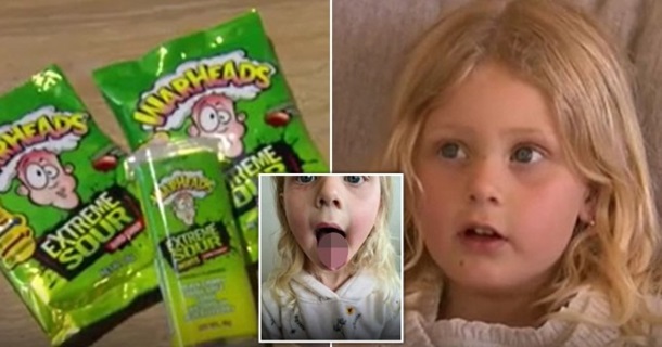 Четырехлетняя девочка получила ожог языка из-за леденцов (фото)