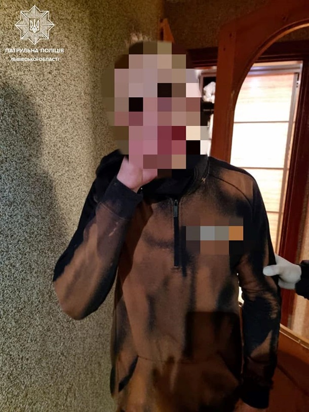 Раны от укусов: во Львове наркоман напал на сожительницу (фото)