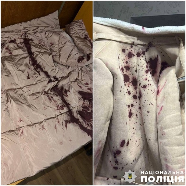 В Киеве задержали «маньяка»: он обливал людей краской