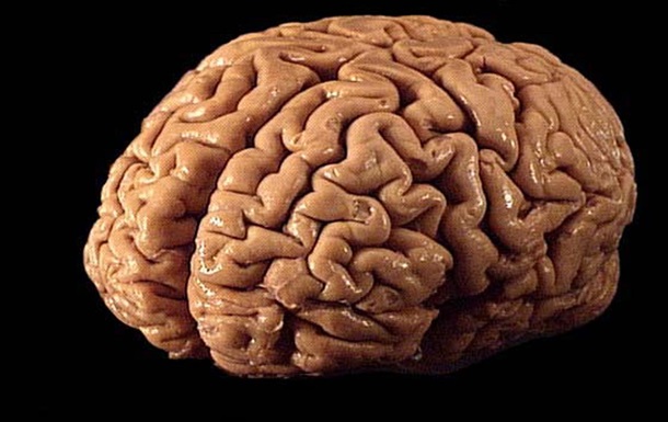 Мозок видатного математика виявився мозком іншого вченого