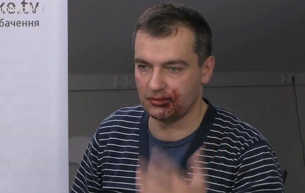 У Києві в Маріїнському парку побили журналістів - ЗМІ