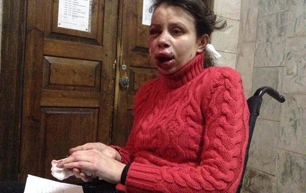 Татьяна Черновол получила тяжелые травмы