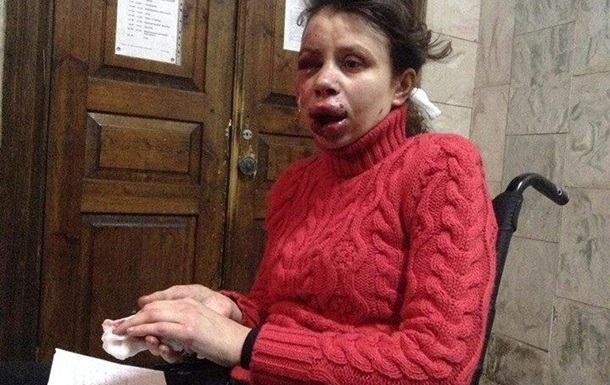 МВС опублікувало фото третього підозрюваного у побитті журналістки Чорновол