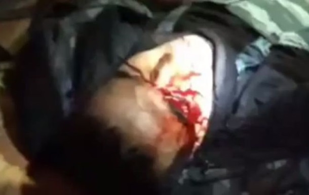 Відео з бійцем Беркута, що втратив око