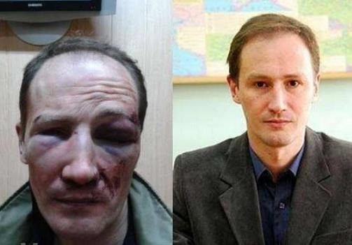 Одесский профессор-националист сам себя избил и ограбил. К чему бы это?