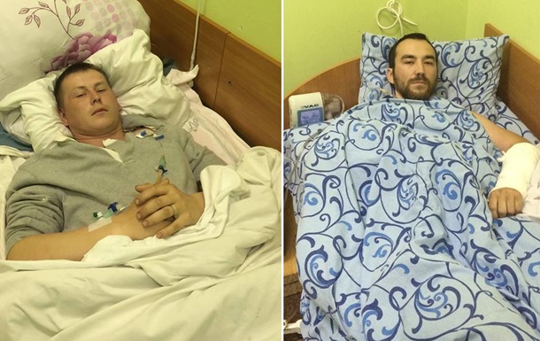 Пленному российскому солдату украинские врачи спасли ногу