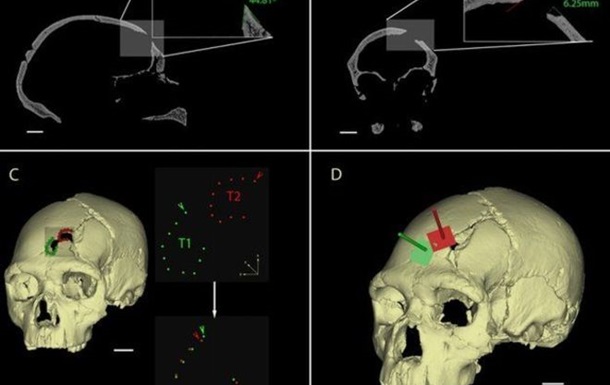 Археологи нашли череп древнейшей жертвы убийства