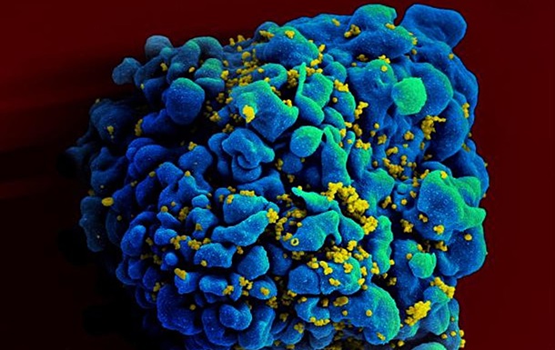 Вирусологам удалось блокировать размножение ВИЧ