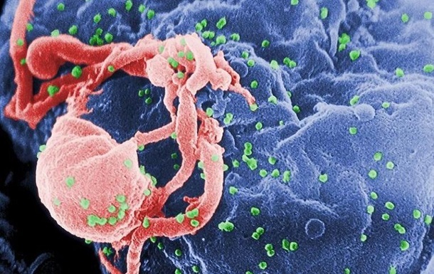 Вірусологи навчились виганяти ВІЛ з клітин організму
