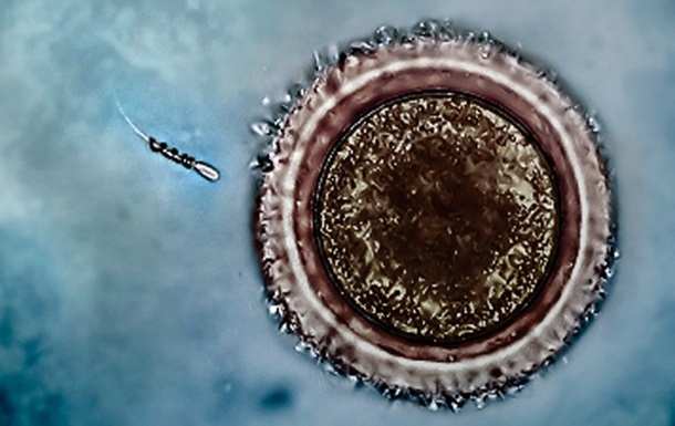 Созданы  спермаботы  для борьбы с мужским бесплодием