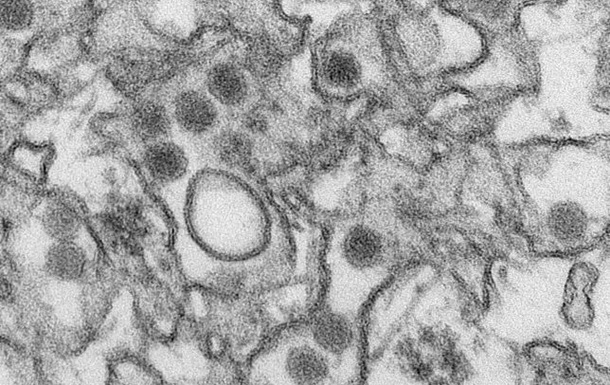Чотири випадки зараження вірусом Зіка виявлено в Канаді