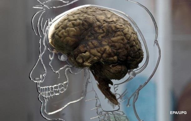 В США собираются оживить мертвый мозг
