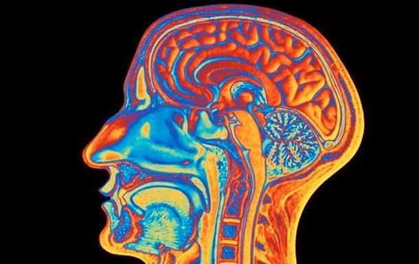 Вчені пояснили причину переваги мозку людини