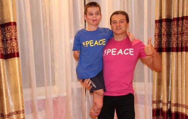 Трюдо відповів на лист хлопчика, покаліченого на Донбасі