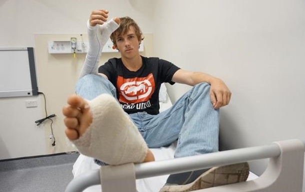 Австралійцю пересадили великий палець з ноги на руку