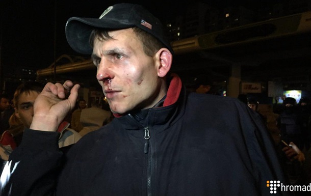 Сутички біля АЗС у Києві: постраждали 14 осіб