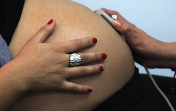 Житель Фінляндії завагітнів після зміни статі - ЗМІ