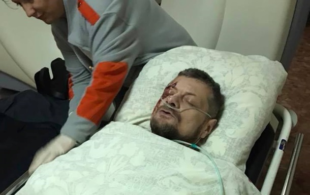 Мосийчук ранен при взрыве в Киеве