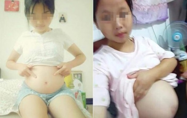 В Китае девочки-подростки хвастаются беременностью в Сети