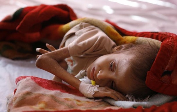В Ємені 130 дітей щодня помирають від голоду та хвороб - Save the Children
