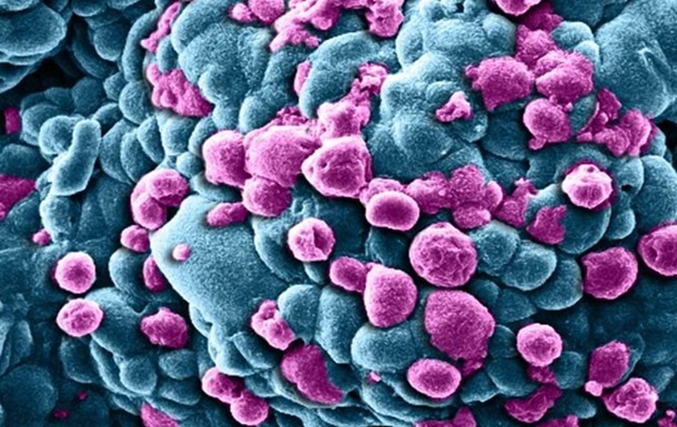 Вчені вперше зняли спрограмовувану смерть клітини