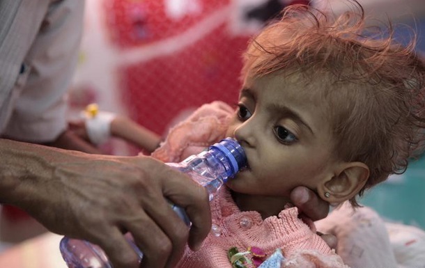 ООН: 14 мільйонів людей в Ємені - на межі голоду