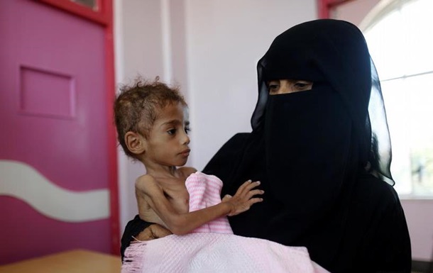 UNICEF: 400 тисяч дітей у Ємені можуть будь-якої хвилини померти