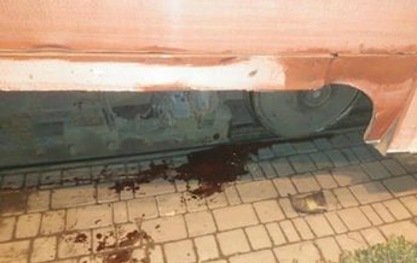 В Одесі чоловік потрапив під трамвай і втратив ногу