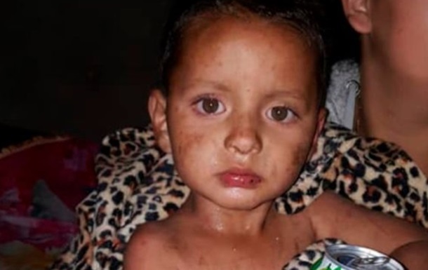 Дворічний хлопчик п ять днів виживав в горах без води і їжі