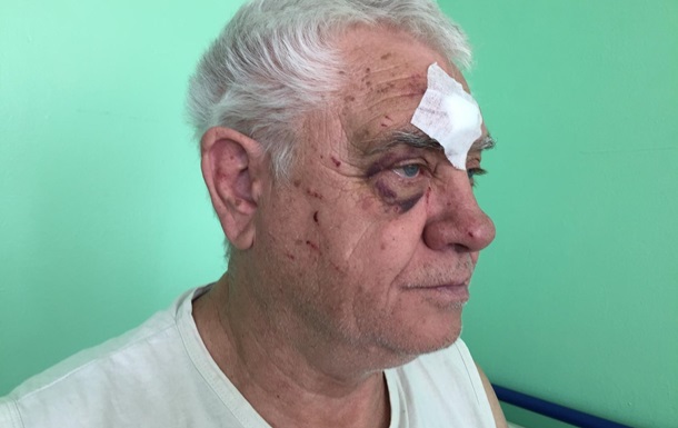 В Харькове коп избил пенсионера за просьбу уступить место в трамвае - СМИ