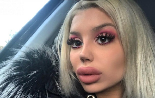 Девушка в 19 лет сделала пластику лица, чтобы стать похожей на Барби