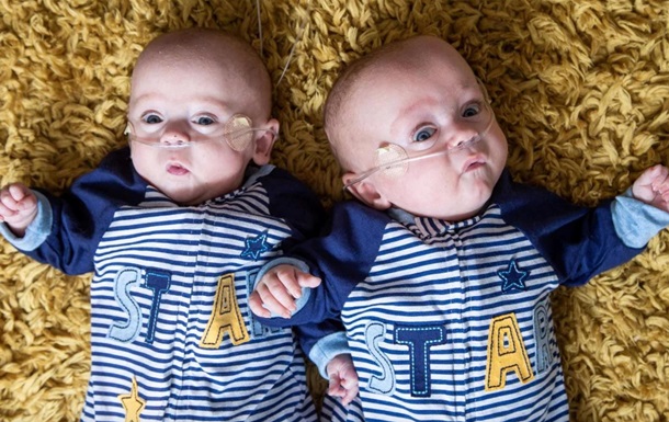 В Британии родились самые маленькие в мире близнецы