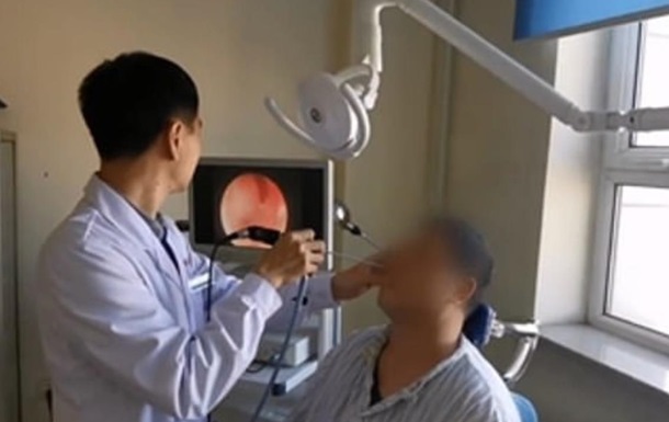 Китаец прожил 20 лет с зубом в носу
