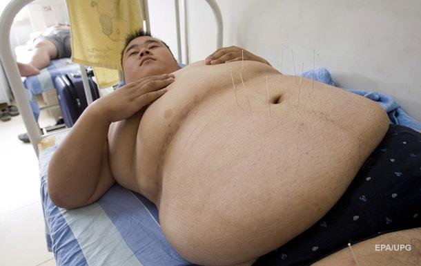 Ученые узнали почему появляется жир на животе 