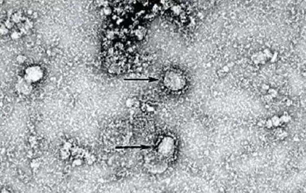 Появилось фото  китайского  коронавируса