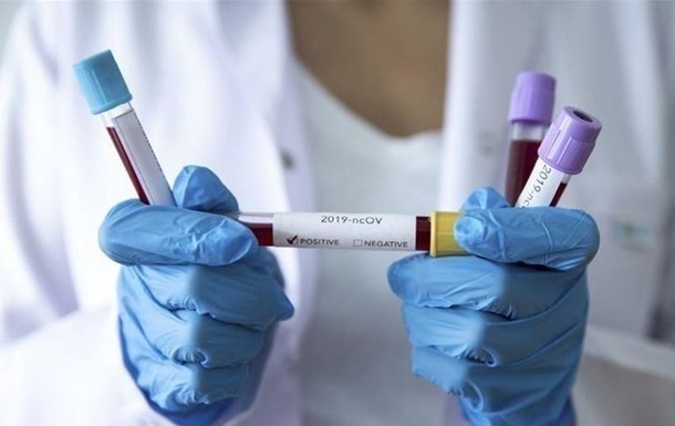 В Украину завезут тесты на коронавирус за 300 гривен