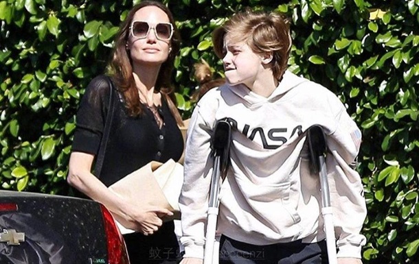 Дочерям Анджелины Джоли и Брэда Питта сделали операции: фото